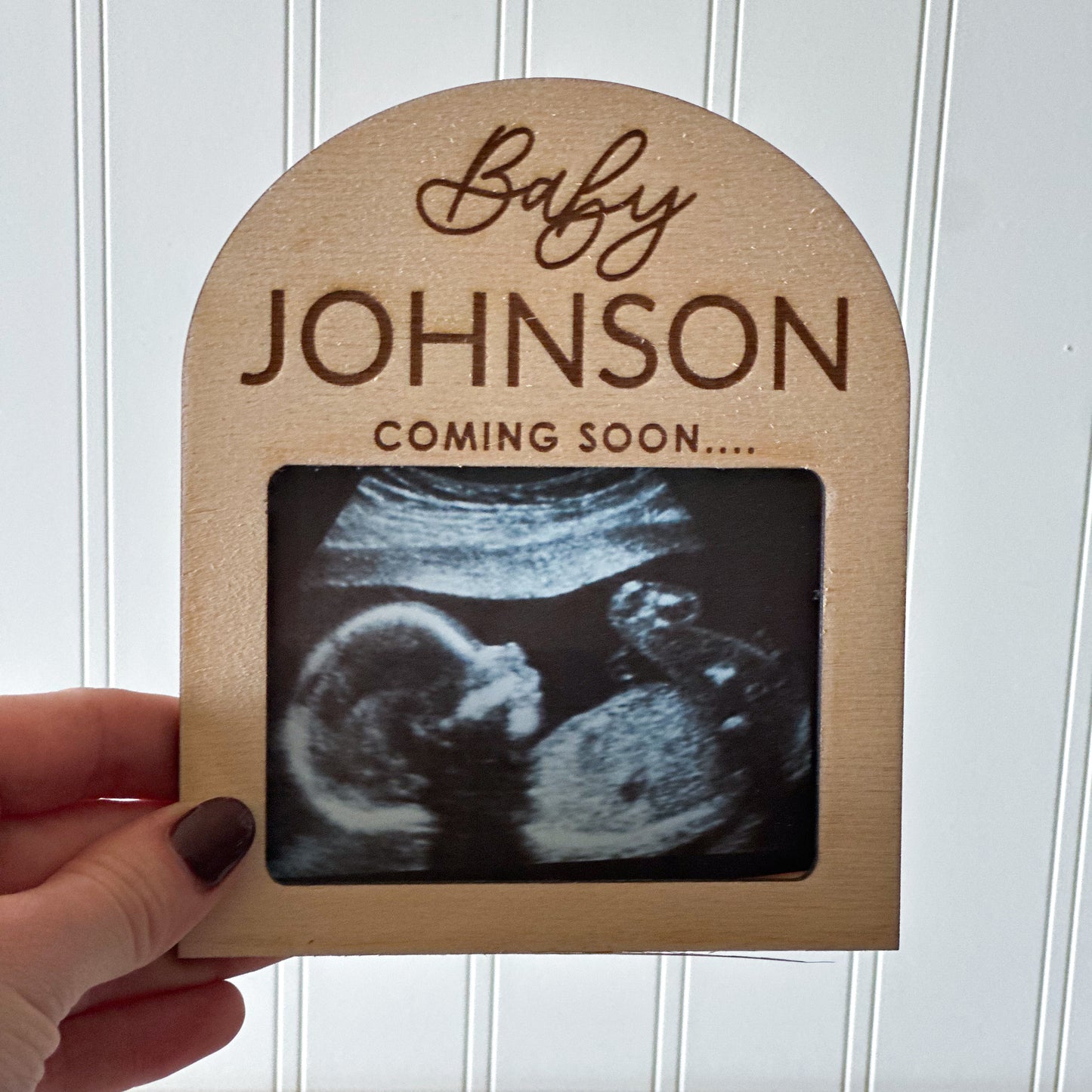 Ultrasounds Photo Magnet - Custom