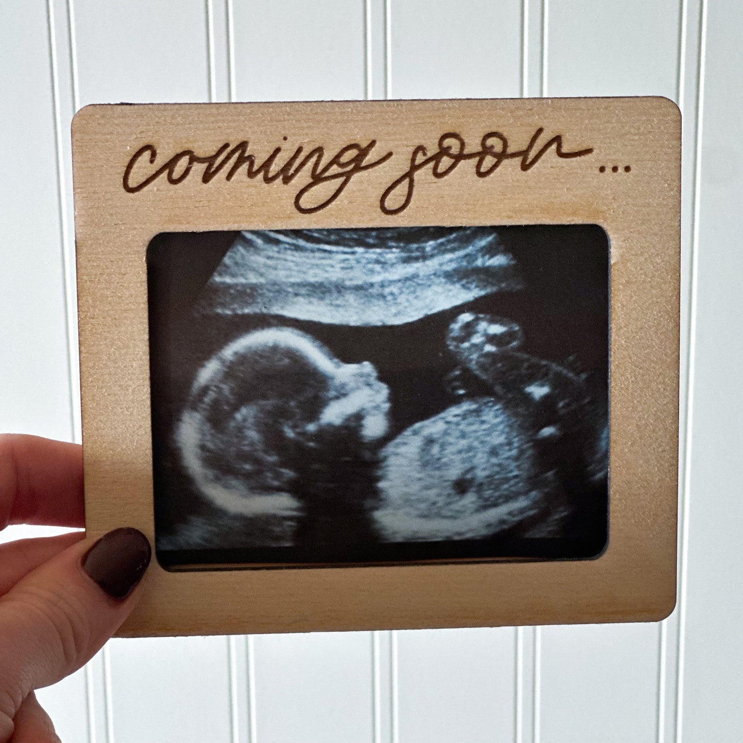 Coming soon Ultrasound photo magnet